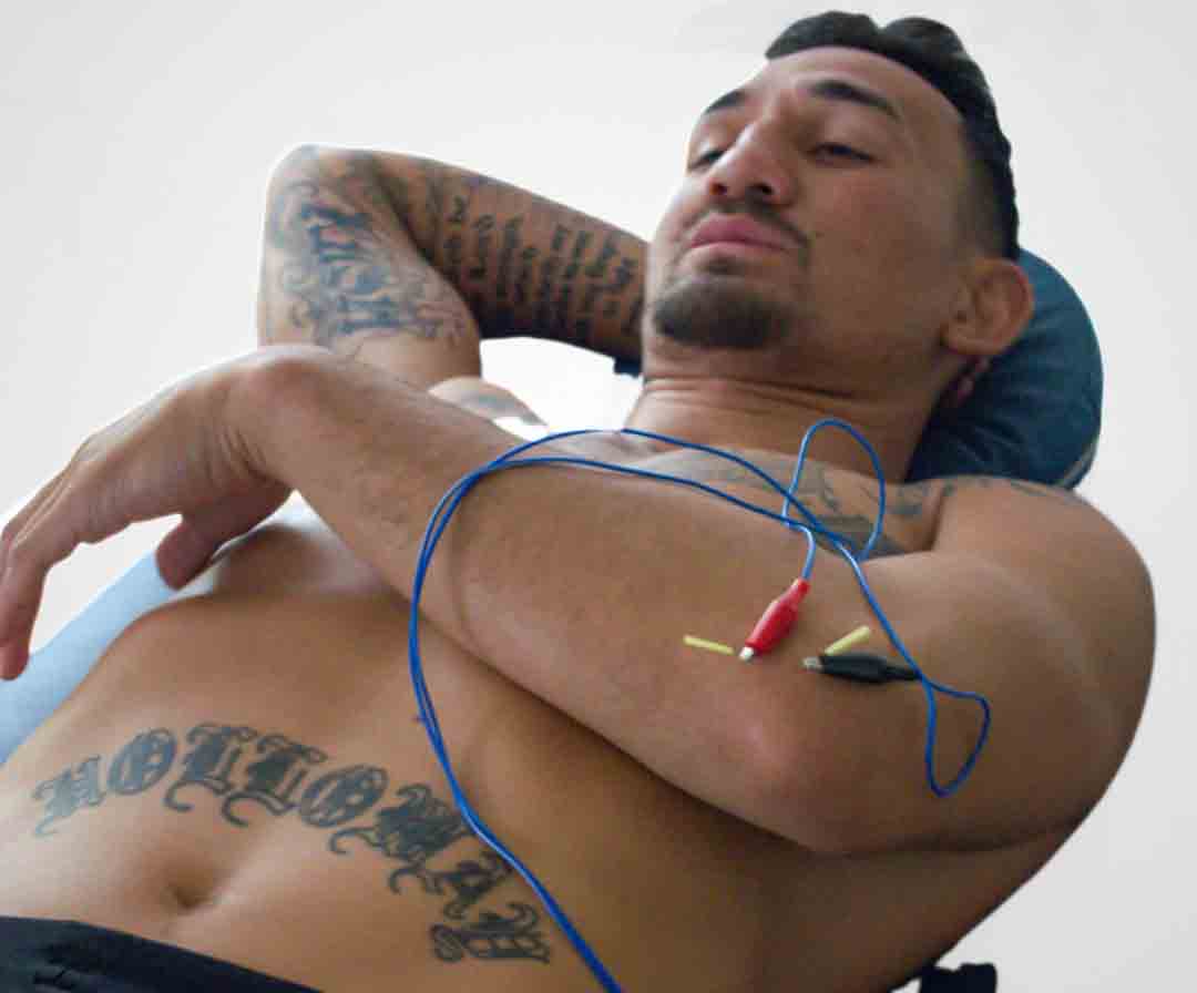 acupuncture kickboxing athlete