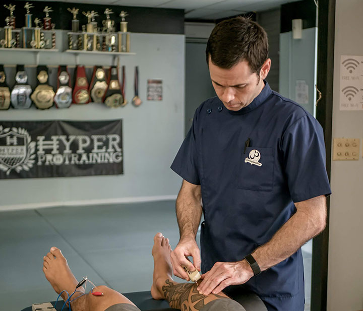 Jackupuncture practitioner performing advanced dry needling therapy at Hyper Pro Training, captured with Hero-Snap technology.